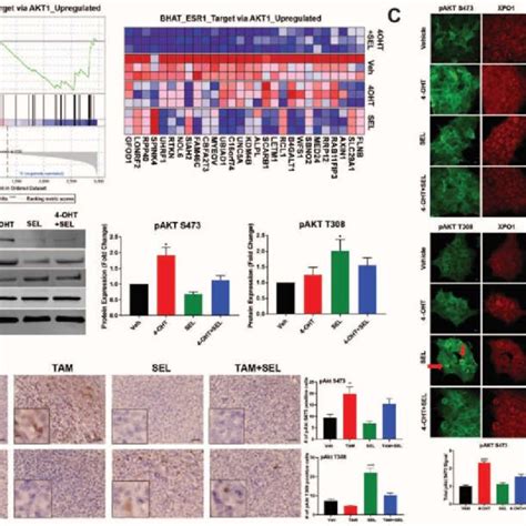 Molecular Mechanism Of Sustained Tumor Regression By Combined Er Xpo