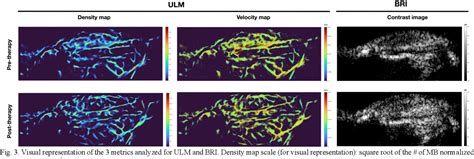 Figure From Ultrasound And Microbubble Mediated Provascular Therapy