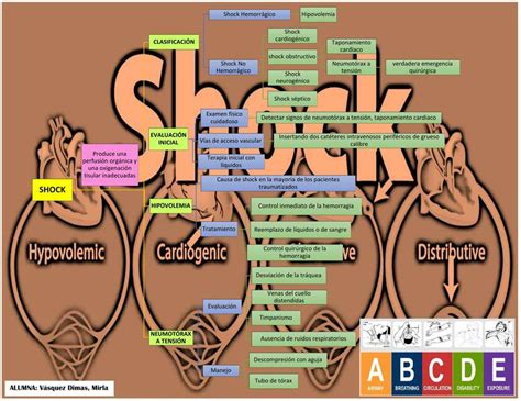 Shock Mapa Conceptual Mirla Vasquez Dimas Udocz