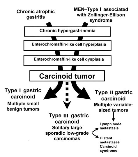 Carcinoid Tumors Of The Stomach A Clinical And Radiographic Study Ajr