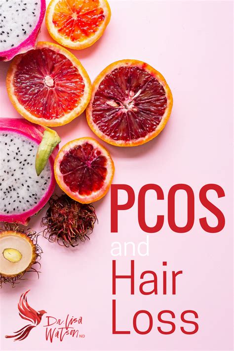 PCOS and hair loss(2) | Dr. Lisa Watson