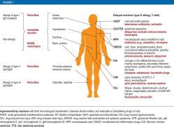 Drug Hypersensitivity Diagnosis Genetics And Prevention