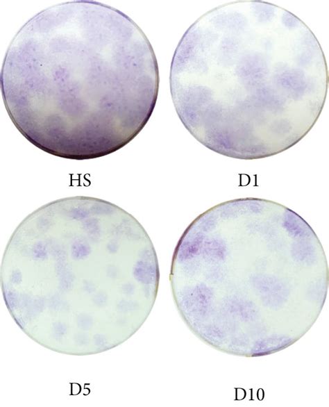 Colony Forming Unit Fibroblast Assay Cfu F Assay A Representative Download Scientific