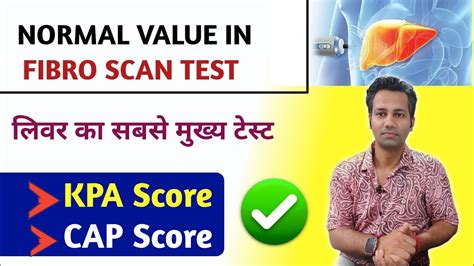 fibroscan test for liver | Normal KPA SCORE , CAP SCORE | fatty liver ...