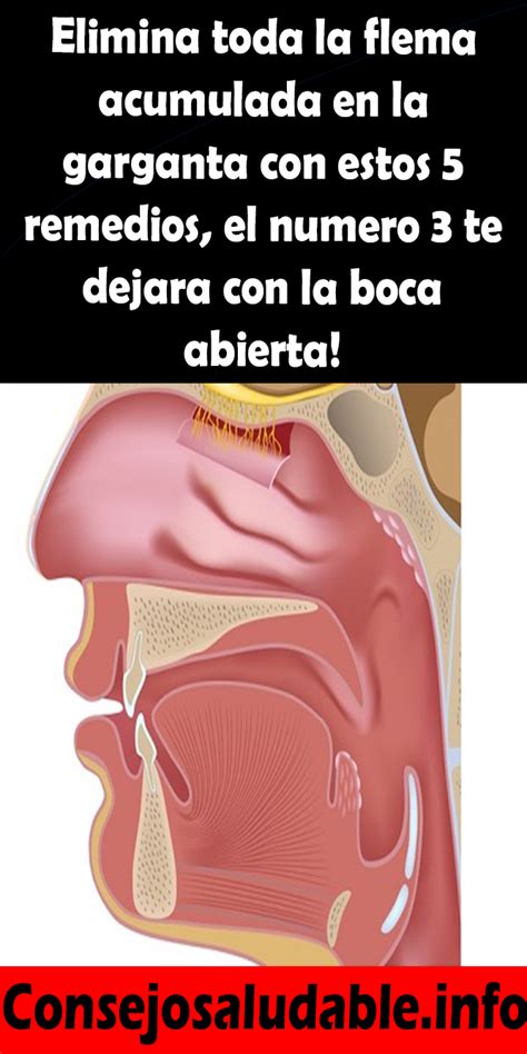 Elimina Toda La Flema Acumulada En La Garganta Con Estos Remedios El