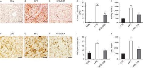 Amelioration Of Hfd Induced Liver Steatosis And Inflammation By Oca