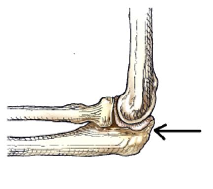 Xray Images For Final Exam Flashcards Quizlet