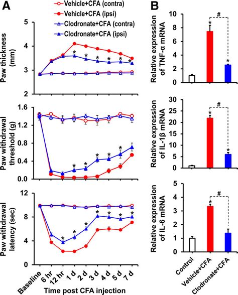 Clodronate Mediated Depletion Of Macrophages Attenuated Cfa Induced Paw