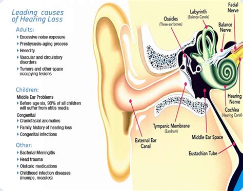 Hearing Loss Polo Park Hearing Centre Winnipeg Hearing Aids