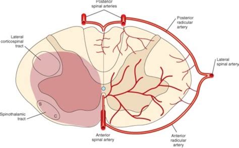 Anterior spinal artery syndrome | Medicine Specifics