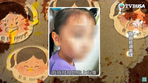 東張西望丨小學女童疑遭校園欺凌被撼頭扯頭髮 母斥校方坐視不理反要求女兒道歉