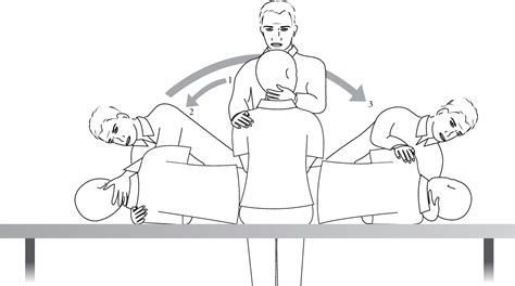 Figure From Benign Paroxysmal Positional Vertigo Bppv 47 Off