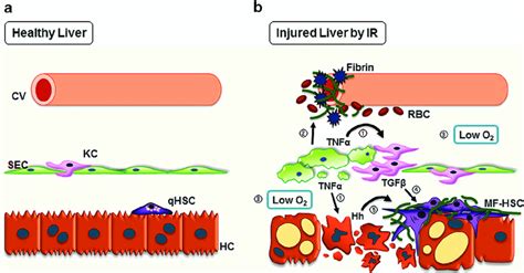 Simplified Model Of Liver Specific Cellular Events In Radiation Induced