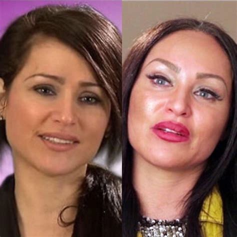 Darcy before surgery original post from r/botched : r/90DayFiance