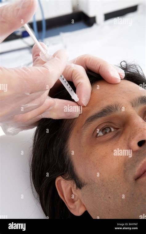 Mfrontalis Botox Injection Site Stock Photo Alamy