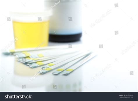 Reagent Strip Urinalysis Routine Urinalysis Checkup Stock Photo