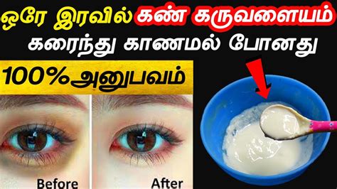 ஒர இரவல கரவளயம கணமல பனத Undereye Cream kan karuvalaiyam