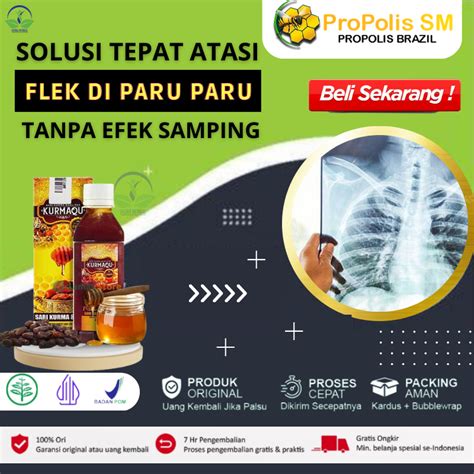 Jual Obat Flek Paru Paru Paru Paru Basah Bronkitis Kronis Batuk