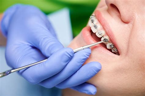 Corrective Dental Treatments Namma Baby Dentist