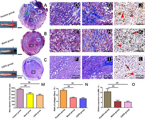 The Results Of Masson S Trichrome Staining Of Collagenous Fibers And