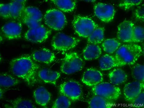 Snx3 Antibody Cl488 68292 Proteintech 武汉三鹰生物技术有限公司