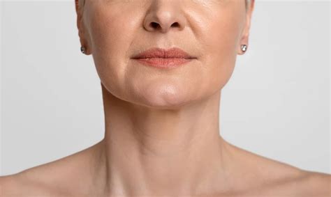 Best Procedure For Sagging Jowls 2024 Shela Violetta