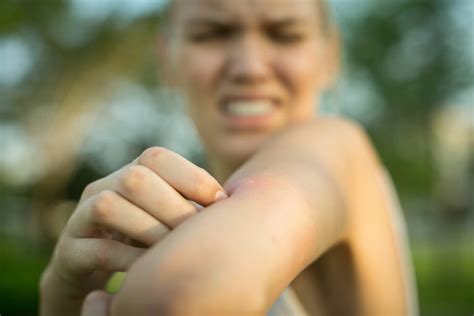 Vor Fernreisen Ber Dengue Fieber Informieren Pta Forum