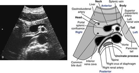 Pancreas Scanning Protocol Radiology Key