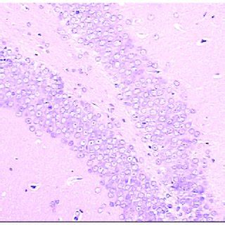 Hematoxylin and eosin staining showing brain neurons of a rat at low ... 