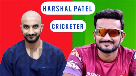 Harshal Patel Hairline Transplant Hair Fall Minoxidil Finasteride