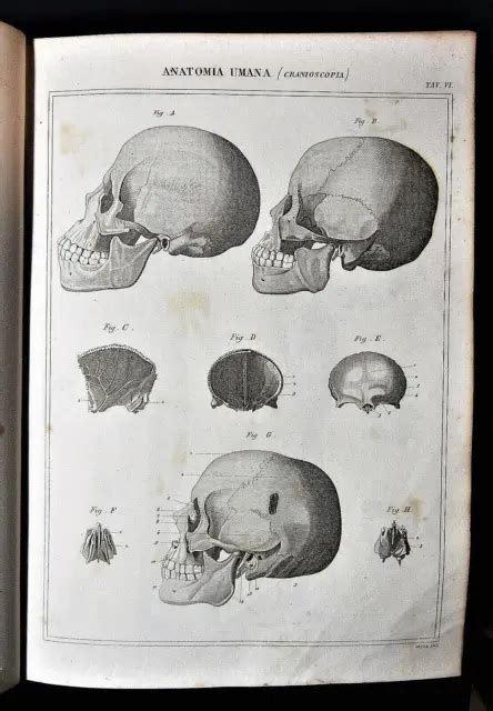 STAMPA ANTICA LITOGRAFIA Anatomia Umana Cranioscopia Old Lithograph