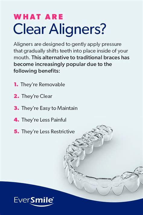 Guide To Wearing Aligners