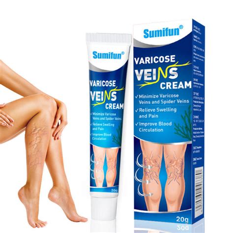 Varicose Veins Remover Treatment Cream Spider Vein Pain Varicosity