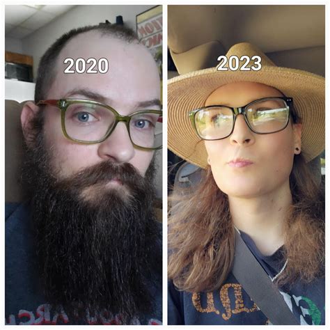 Nearly Two Years Hrt No Ffs 46 Mtf Rtranstimelines