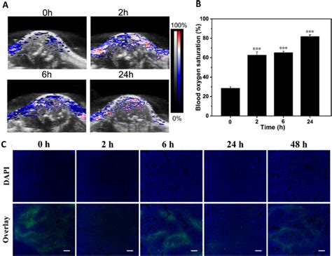 MCF 7 tumour bearing BALB c nude mice injected with 100 μL of