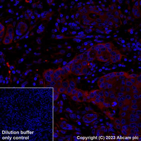 Recombinant Alexa Fluor 647 Anti Prolactin Receptor PRL R Antibody