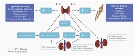 CKD MBD Mineral Bone Disease Edren Org