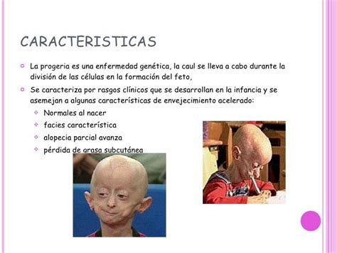 Progeria Pre