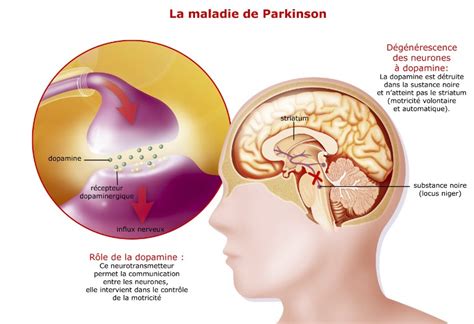 Maladie De Parkinson Les Neurones Greffés Sont Fonctionnels Pendant 14 Ans Sciencesetavenir Fr