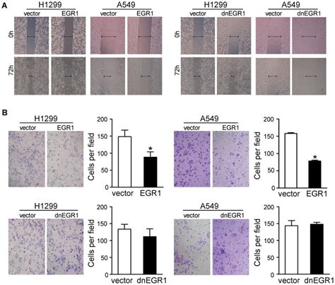 A The Effect Of EGR1 On Cell Migration Was Determined By Wound