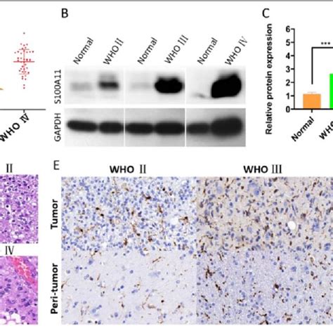 The Relative S100a11 Mrna Expression In Different Glioma Cell Lines And