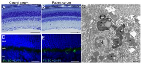 Toluidine Blue Staining A And B And Tem Micrographs C Are Of A