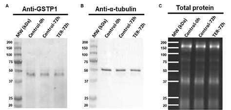 Figure 1 From Deactivation Of The JNK Pathway By GSTP1 Is Essential To