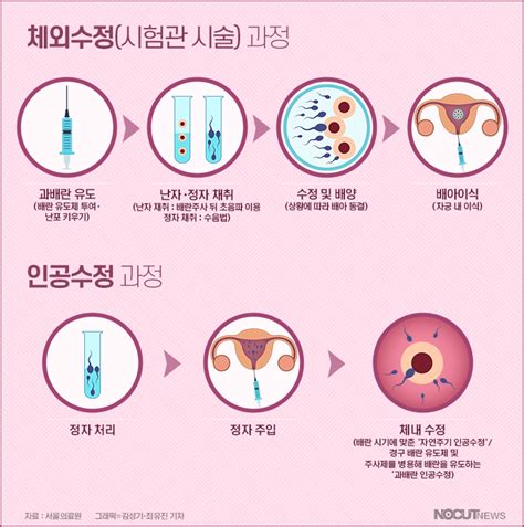 그래픽 난임 지원에 성패 따지는 정부저출생 손놨나 노컷뉴스