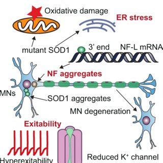 Schematic Overview Of The Underlying Pathogenic Mechanisms Of Als