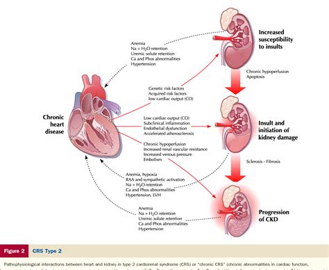 Cardio Renal Syndrome Semantic Scholar