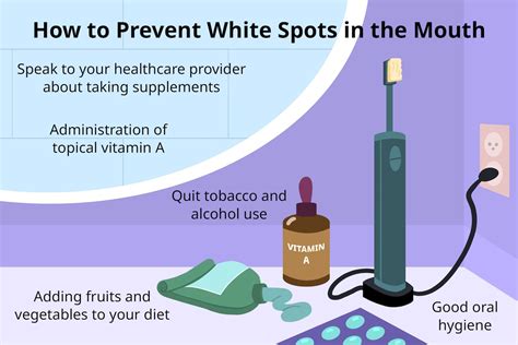 White Spots in the Mouth: What Causes Them?