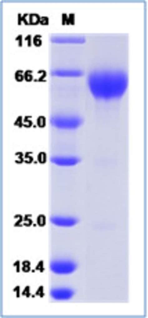 Sino Biological Human PD1 PDCD1 CD279 Protein Fc Tag 500ug