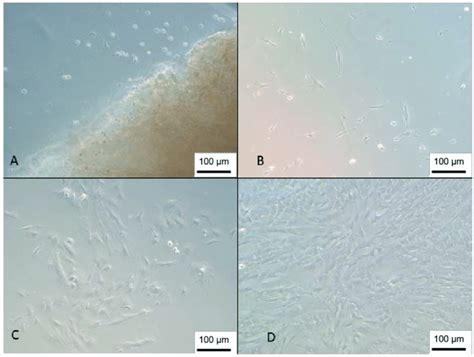 Isolation Of The Wj Msc A Cells 1 Day After Isolation Next To A Download Scientific Diagram