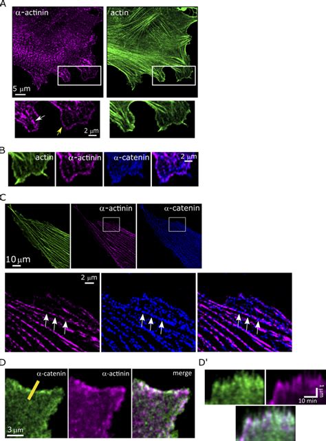 Catenin And Actinin Do Not Colocalize A Immunostaining In Wt